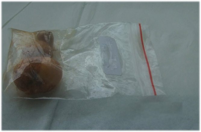 酢浆草种球如何保存